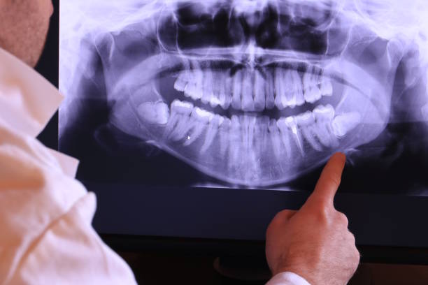 Best Knocked-Out Tooth Emergency  in Wilmer, TX