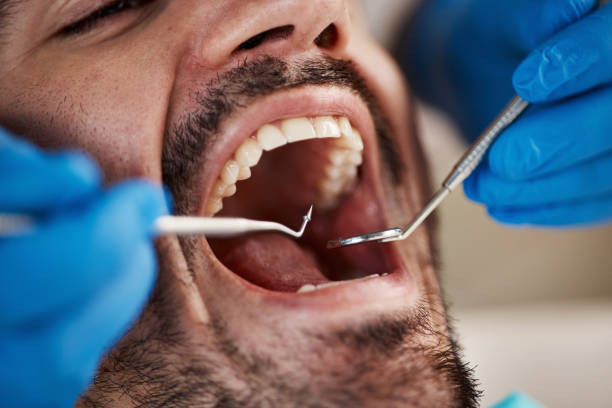 Best Emergency Tooth Extraction  in Wilmer, TX